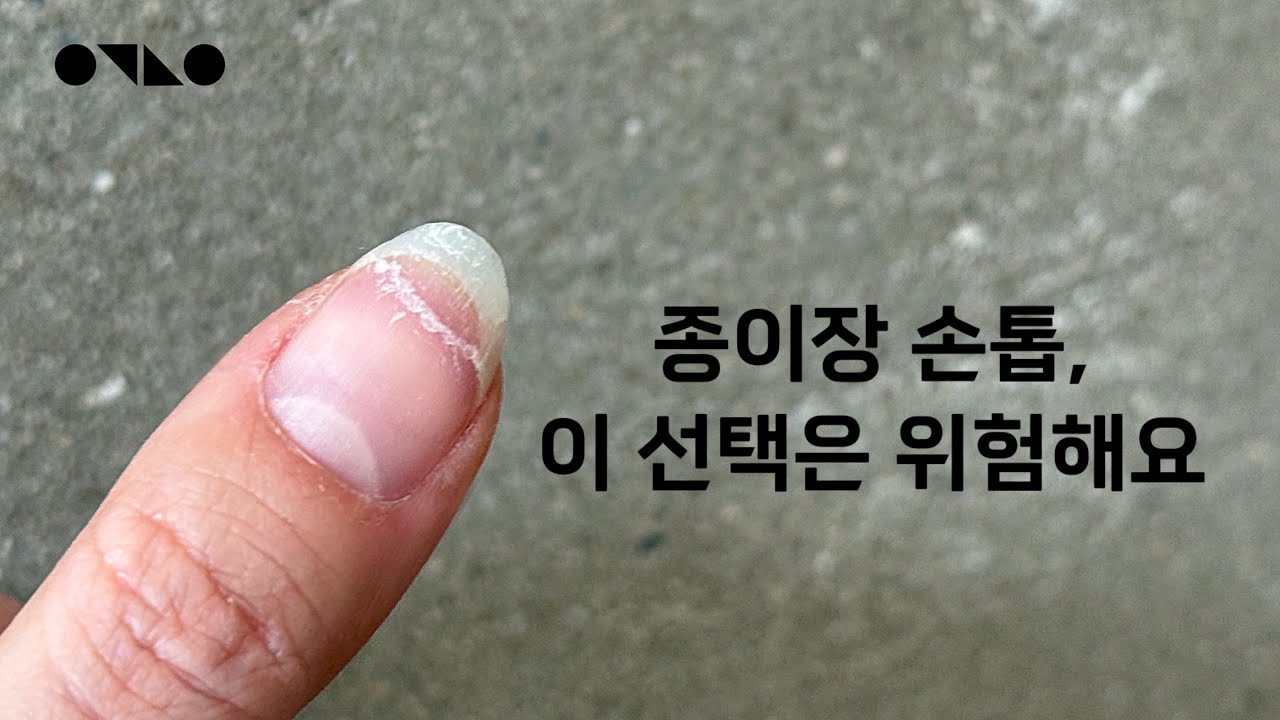 종이장 손톱, 왜 자꾸 뜯어질까? 문제는 손톱이 아니라 ‘안 맞는 선택’입니다