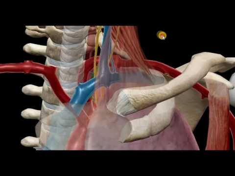 Video: Aorta Trombo-embolie