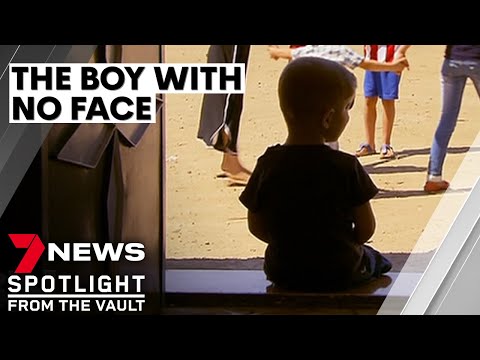 Video: A Kid With A Human Face Was Born In Malaysia - Alternative View