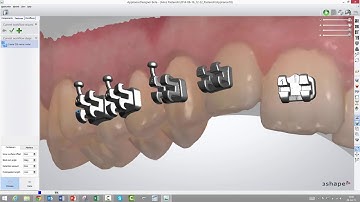 How to create a bracket transfer media in Appliance Designer