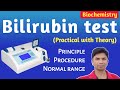 Bilirubin test එක ගැන  liver function test Sinhala  Total,direct,indirect (Clear explanation)