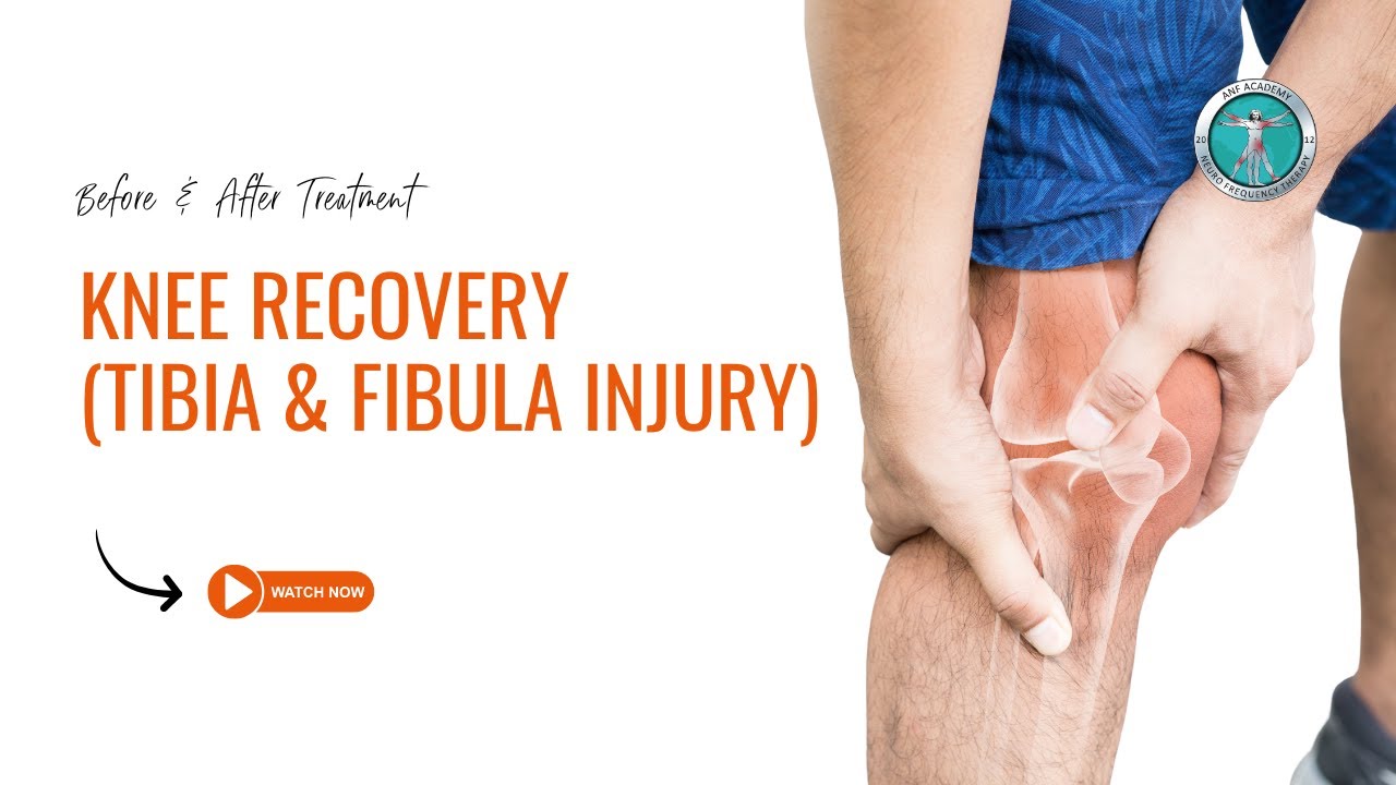 Knee Recovery (Tibia & Fibula Injury) : Before & After ANF Treatment ...