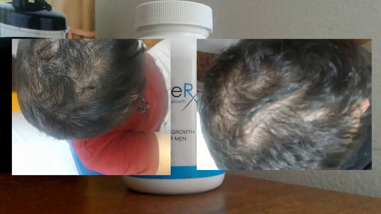 Como tomar follicle rx