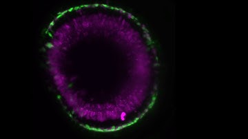 Retinal development at the single cell level