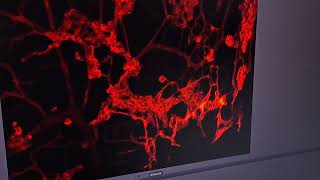 Capturing a retinal microvascular Z stack image on thr Zeiss LSM 900 confocal microscope.