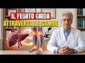 Questi Sintomi sulle Gambe Dicono che il Tuo Fegato È in Pericolo — Controlla Stasera!