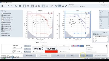 Understanding a Hearing Test