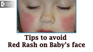 Baby cheeks red and dry in winter |Causes & Remedies - Dr. Rashmi Ravindra | Doctors' Circle screenshot 5