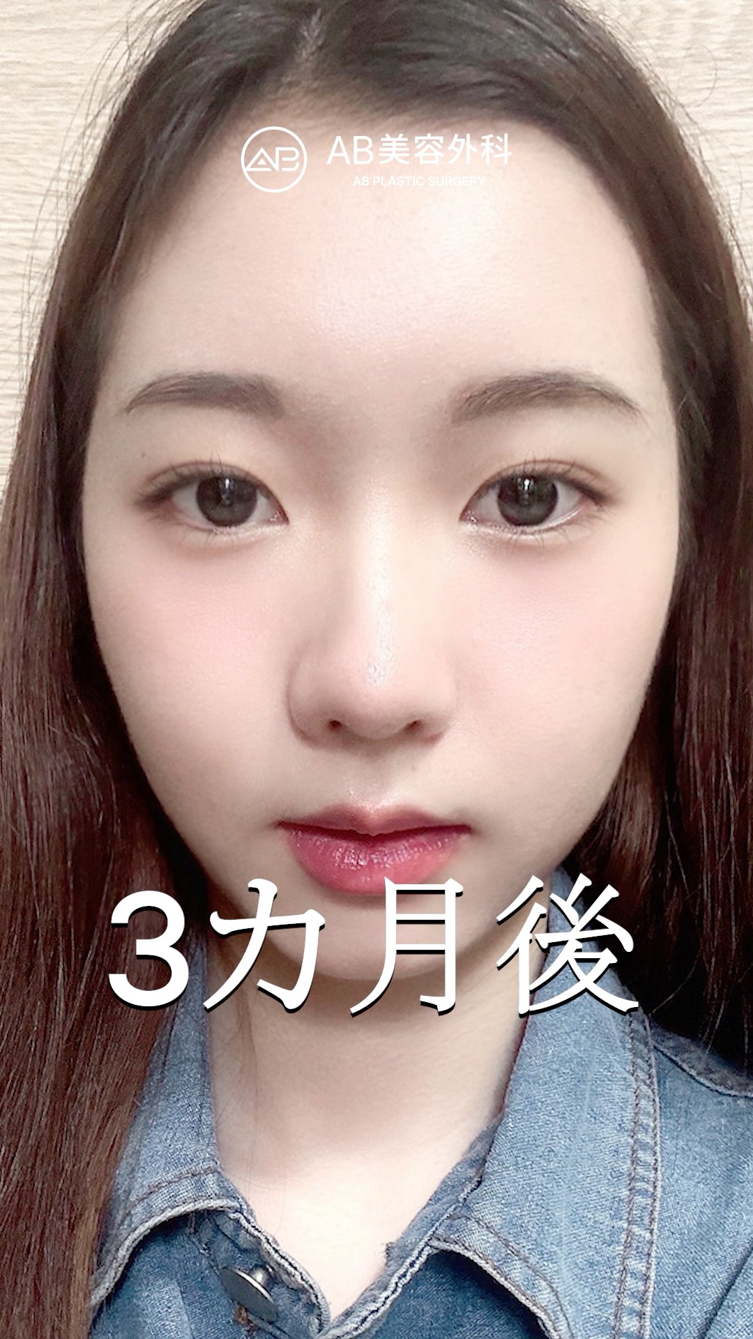 自然すぎる二重…これが韓国整形！ #shorts