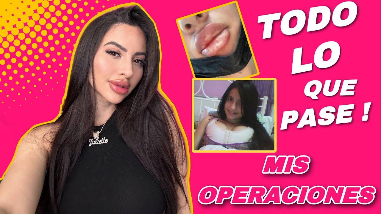 TODAS MIS CIRUGIAS/ MAL PROCEDER EN MIS LABIOS 