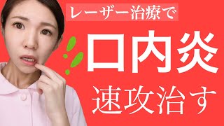 口内炎の治し方！歯医者でレーザー治療が良い！？看護師検証【即効効果あり】