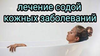 Лечение кожных заболеваний содой. Наружное применение соды. Домашняя аптека. Народные методы.