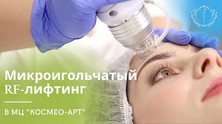 видео: МИКРОИГОЛЬЧАТЫЙ RF-ЛИФТИНГ картинка: МИКРОИГОЛЬЧАТЫЙ RF-ЛИФТИНГ