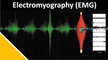 EMG (Electromyography) in Biomechanics | Delsys