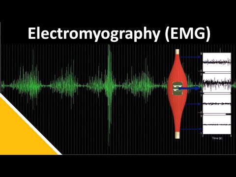 EMG (الکترومیوگرافی) در بیومکانیک | دلسیس