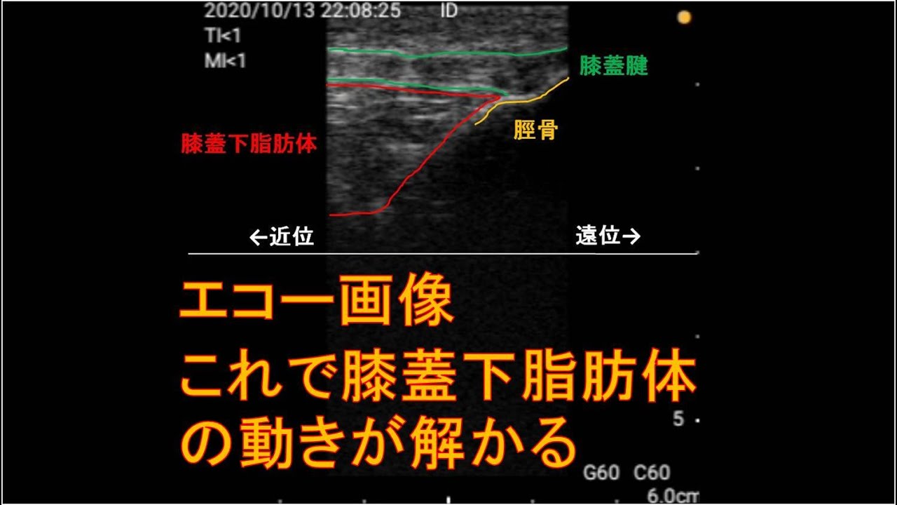 まとめ編 膝蓋下脂肪体 エコーで正常人の動きが解かるシリーズ Ept Note まとめ編 膝蓋下脂肪体 エコーで正常人の動きが解かるシリーズ Ept Note