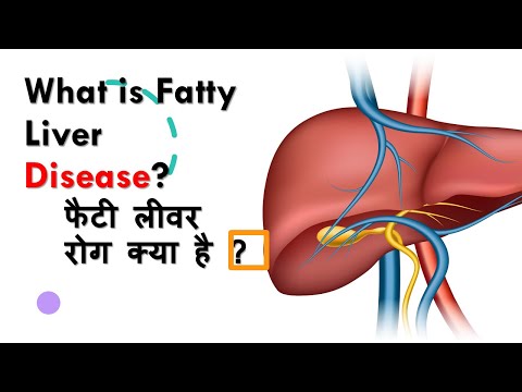 फैटी लीवर रोग क्या है ? /what is Fatty Liver Disease