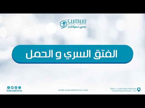 الفتق السري و الحمل