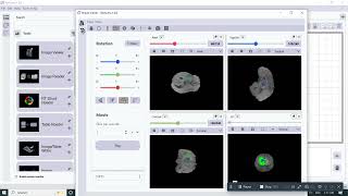 Image Viewer | Medical Image Visualization with Radiuma | Radiuma Tutorial