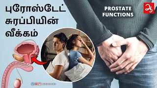 ஆண்களுக்கு ப்ராஸ்டேட் சுரபி வீங்குவது ஏன் ? Swollen Prostate Treatment for prostate enlargement