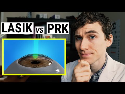 Video: PRK-procedure: Bijwerkingen, Kosten En Herstel