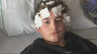 Bocah laki-laki berusia 12 tahun menjalani operasi otak saat terjaga