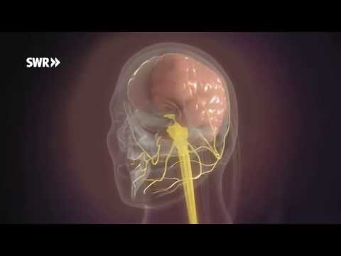 Video: Was macht Migräne mit dem Gehirn?