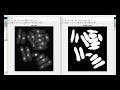 Image segmentation using fuzzy logic matlab code