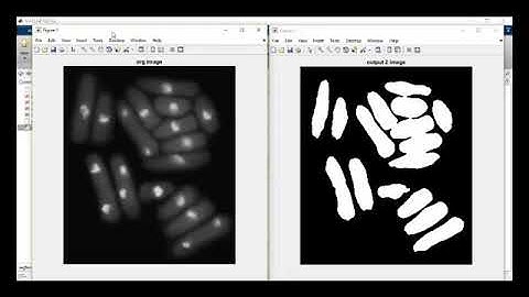 image segmentation using fuzzy logic MATLAB code