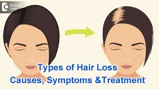 Types of Hair Loss | Common Causes, Symptoms \& Treatment - Dr. Kavitha GV Mandal