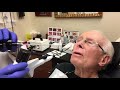 In Office Demonstration of Cryotherapy of the nose