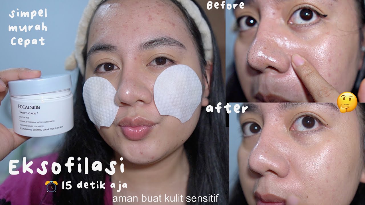 EKSFOLIASI 15 DETIK AMAN UNTUK KULIT SENSITIF REVIEW FOCALSKIN SAFELY EXFOLIATE CLEAR PADS