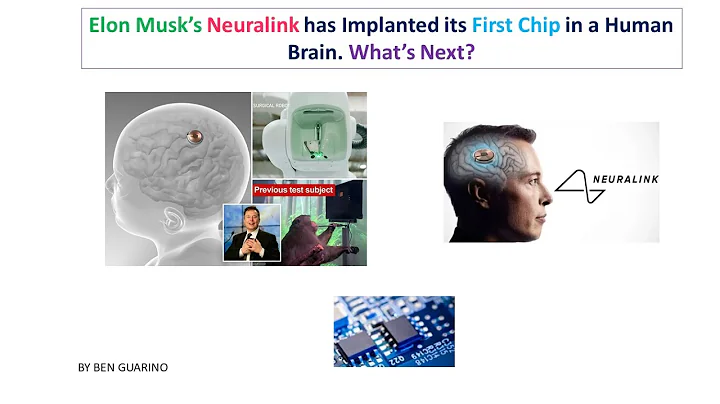 Elon Musk’s Neuralink has Implanted its First Chip in a Human Brain. What’s Next?