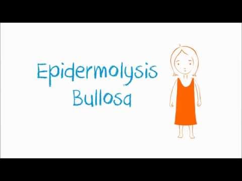 Video: Tantangan Hidup Dengan Dan Mengelola Epidermolisis Bulosa: Wawasan Dari Pasien Dan Pengasuh