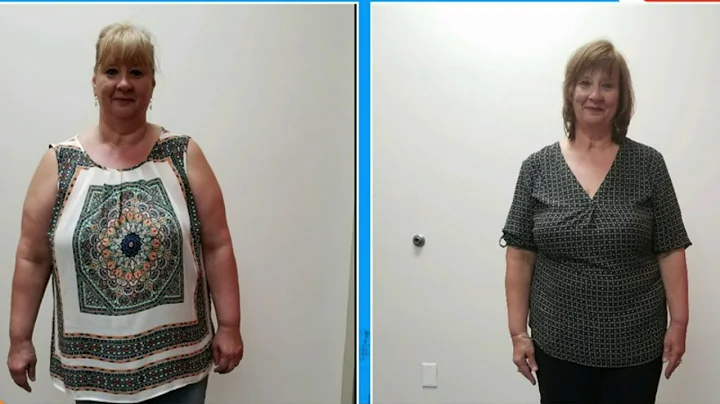 Dr. Guthrie Weight Loss on Live In The D