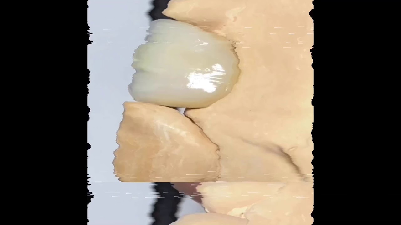 SR Nexco, estratificando un central. TPD Mariano Maurizi