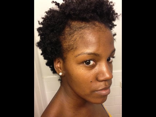 Natural Hair Thinning Edges How To Grow Edges And Bald Spots