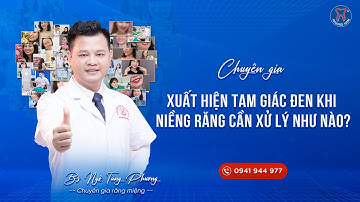 Giải Pháp Hiệu Quả Cho Vấn Đề Tam Giác Đen Khi Niềng Răng | Chuyên Gia Chia Sẻ