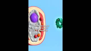 Danon disease #humanbiology #rarediseases #science