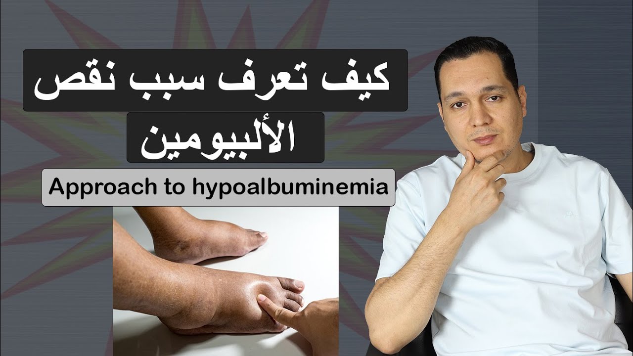 كيف تصل لسبب نقص الألبيومين فى الدم / Approach to hypoalbuminemia
