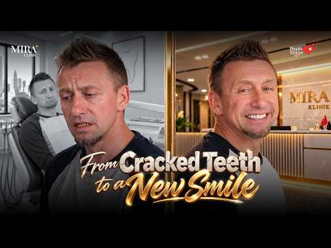 Justin Thomas from the US | 24 Crowns, Zero Pain & an Award-Winning Smile at Mira Clinic