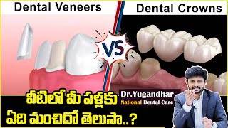 వీటిలో ఏది బెస్ట్ | Differences Between Veneers and Crowns | Smile Design | NDC Doctor Yugandhar