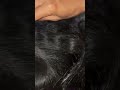 #fypviralシ #statisfying #Lice #hair #LiceOnHead #liceremoval #brasil #xyzbcafyp #licecomb  #kutu