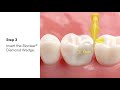 3m filtek dental restoratives and bioclear