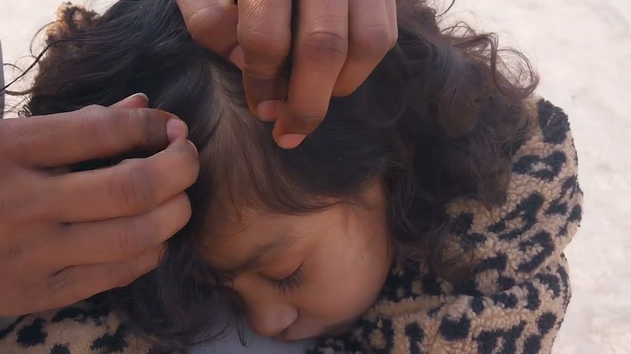 Nitpicking ASMR  video 184 #kuto   #piolhos   #carikutu