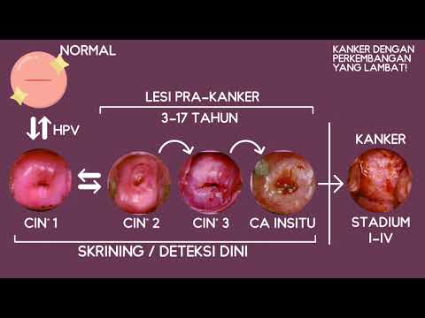 Video: Spesialis apa yang menangani displasia fibromuskular?