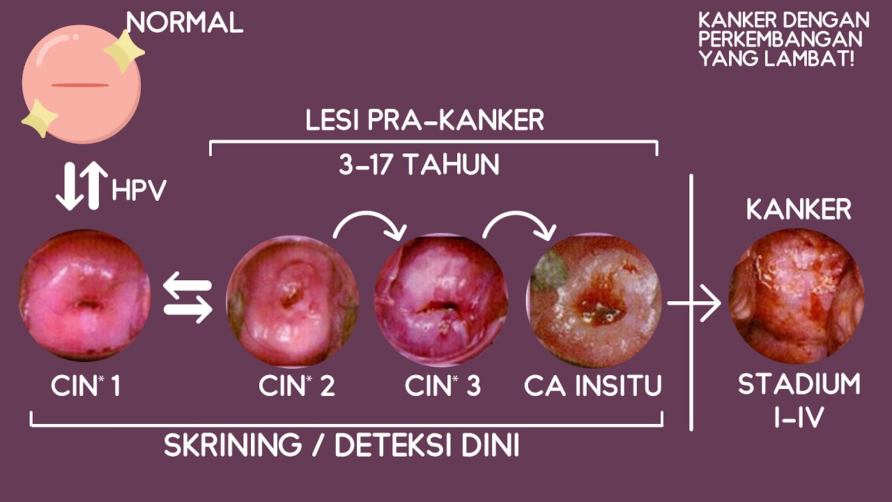Rahim gambar yang normal mulut solusi penyakit
