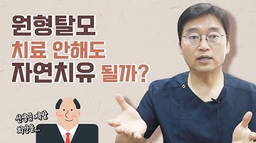 원형탈모 치료 안해도 자연치유 될까?