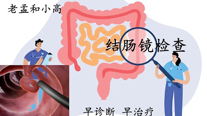 结肠镜检查 - 天天要闻