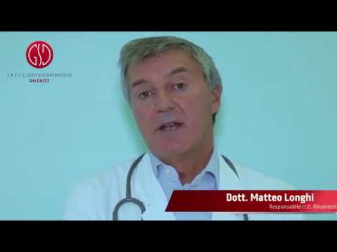 Video: Quando L'artrite è Una Disabilità?